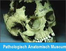Pathologisch Anatomisch Museum